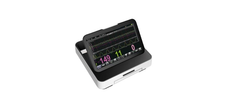 Fetal Monitor
